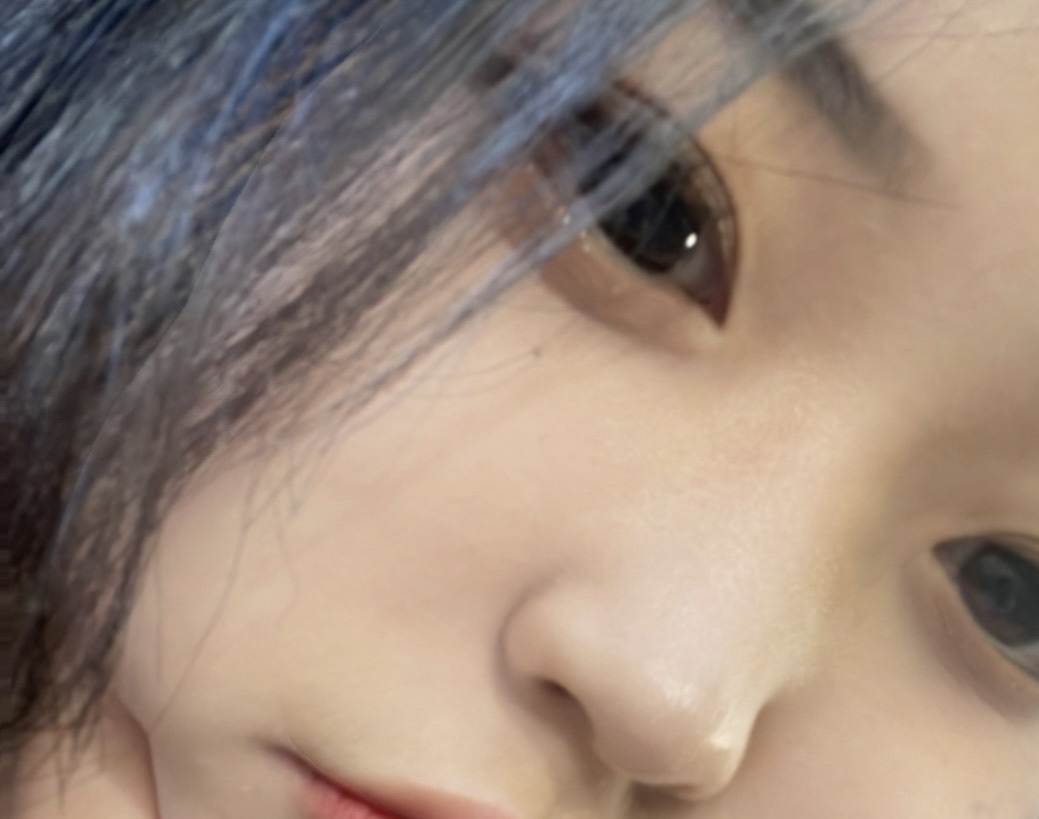 콧대(자가조직) 후기