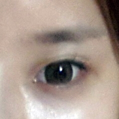 쌍꺼풀(자연유착) 후기