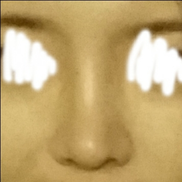 콧대(보형물) 후기