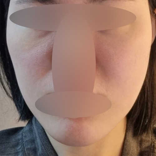 실리프팅 후기