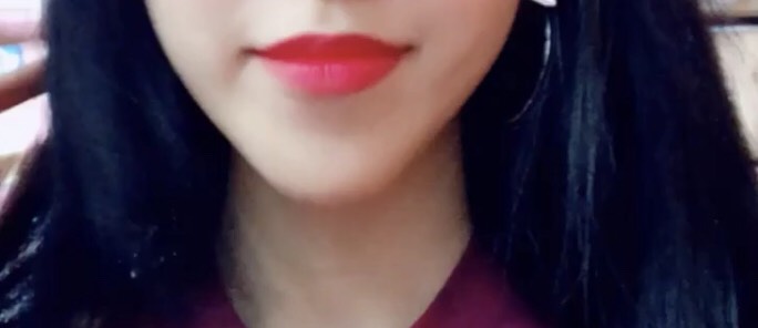 입꼬리성형 후기
