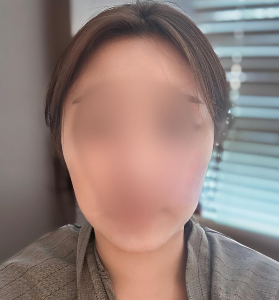 실리프팅 후기