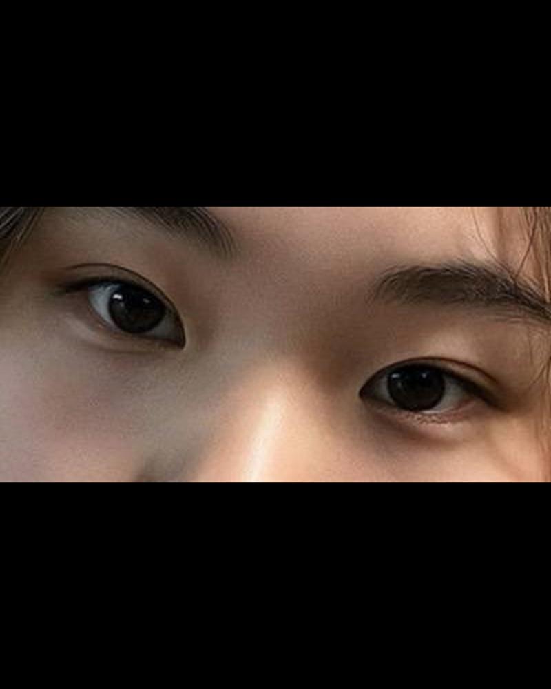밑트임 후기
