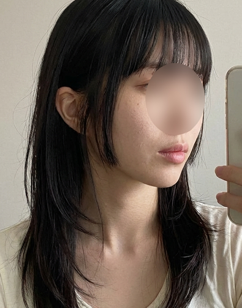 온다리프팅 후기