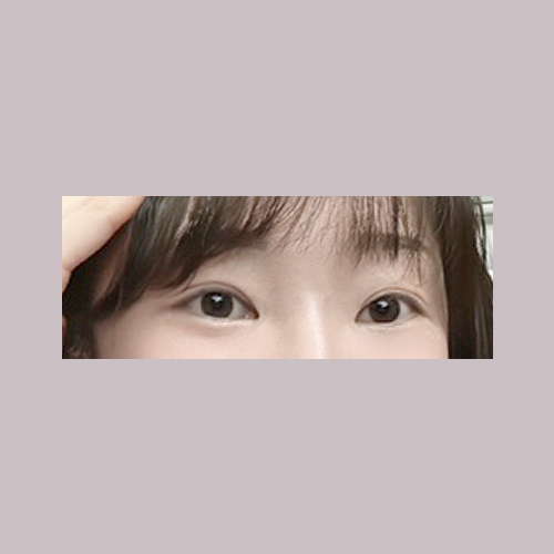 밑트임 후기