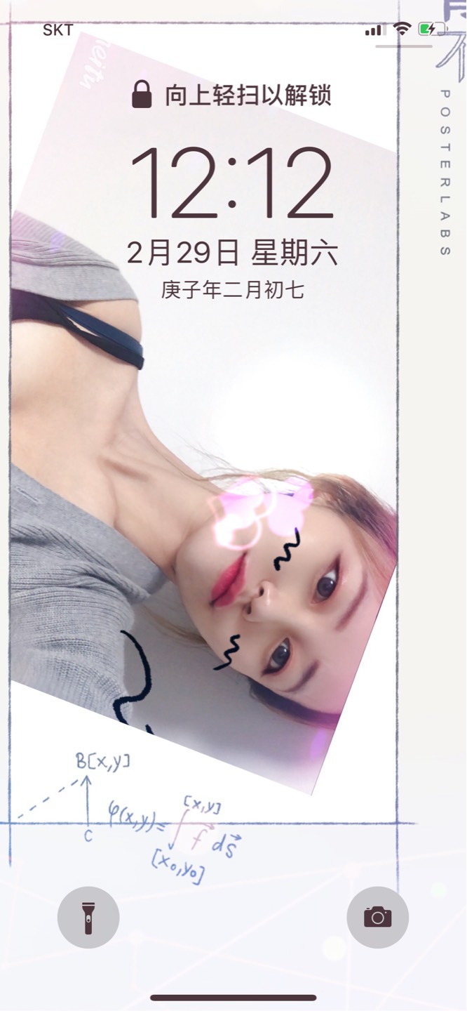 입꼬리성형 후기