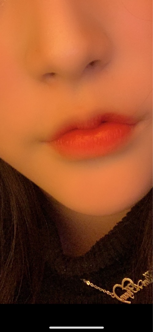 입꼬리성형 후기