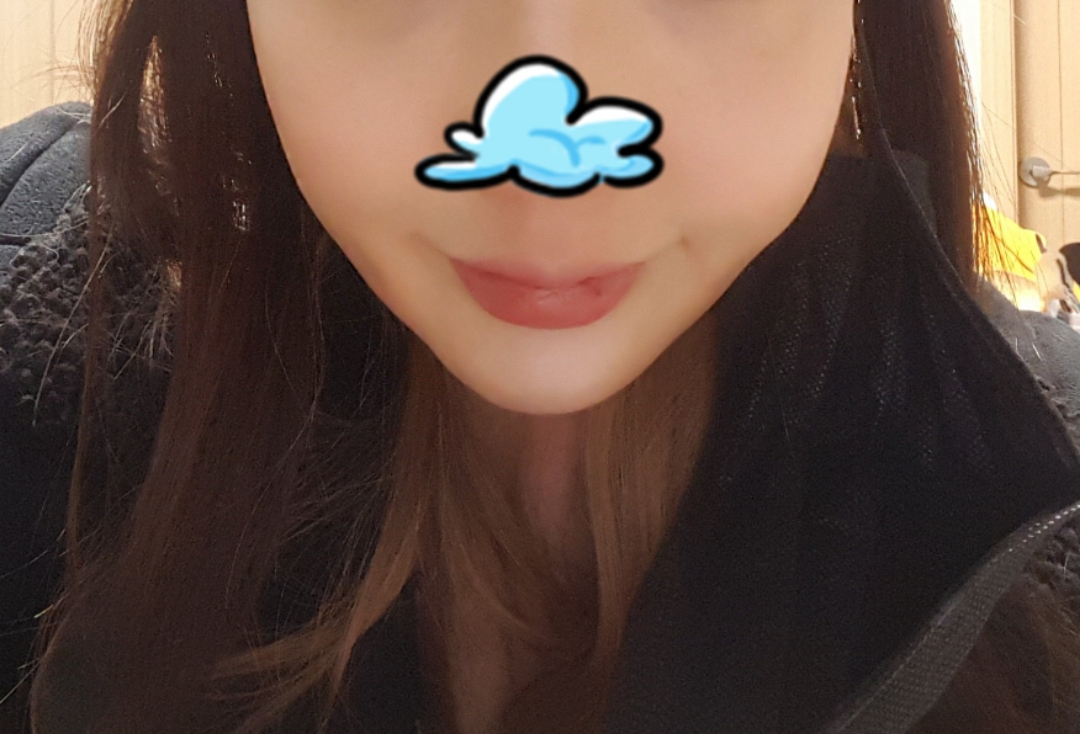 실리프팅 후기