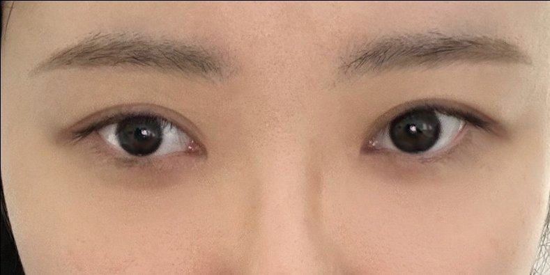 밑트임 후기