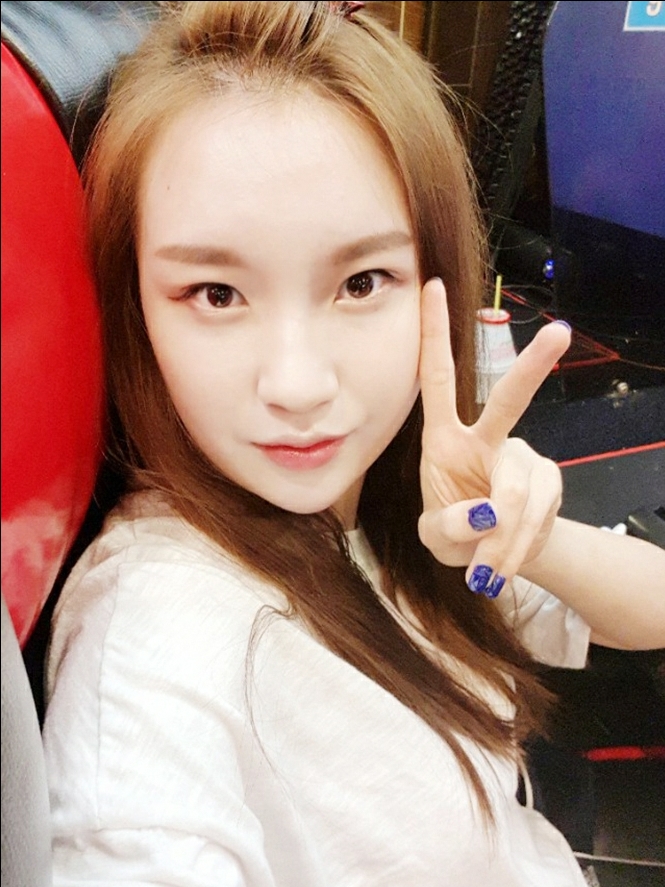 콧볼보톡스 후기