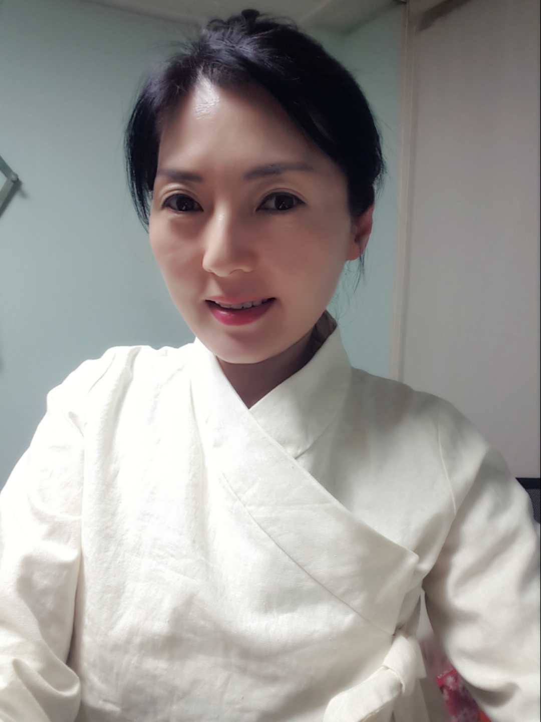 입꼬리성형 후기