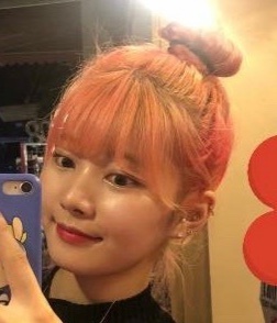 쌍꺼풀(매몰) 후기