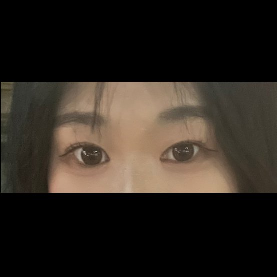 밑트임 후기