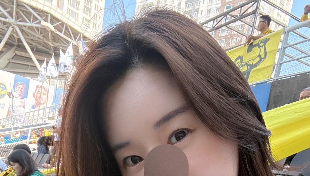 눈재수술 후기