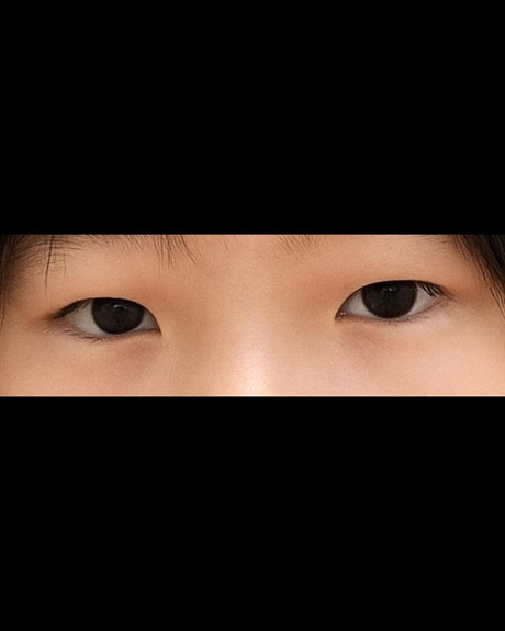 밑트임 후기