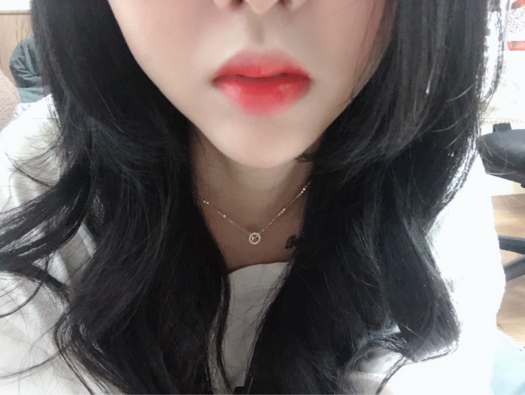 입꼬리성형 후기