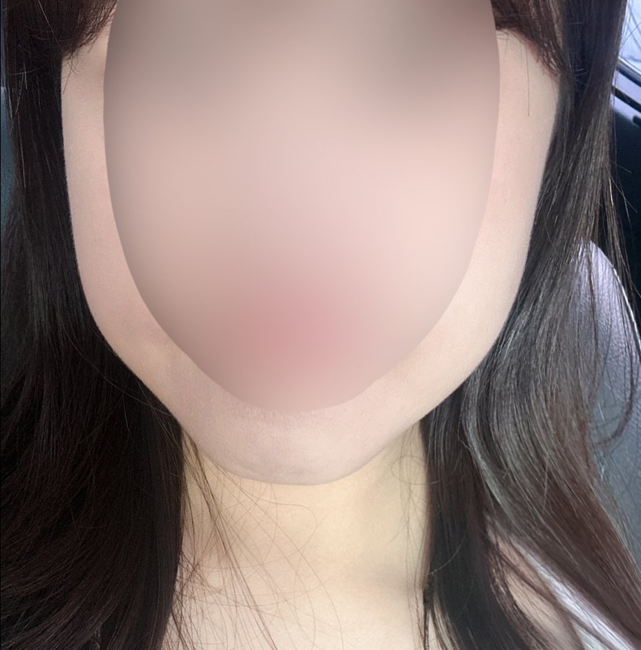 실리프팅 후기