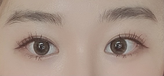 밑트임 후기