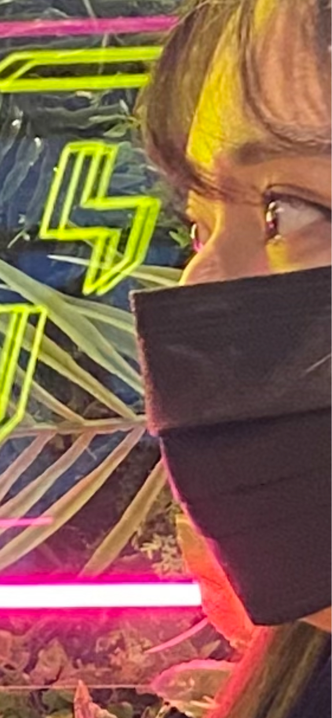 콧대(보형물) 후기