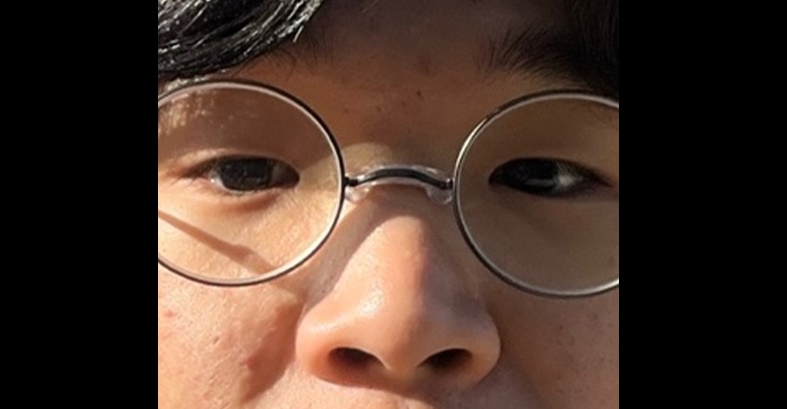 콧대(보형물) 후기