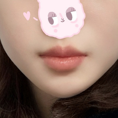 큐피트라인성형 후기