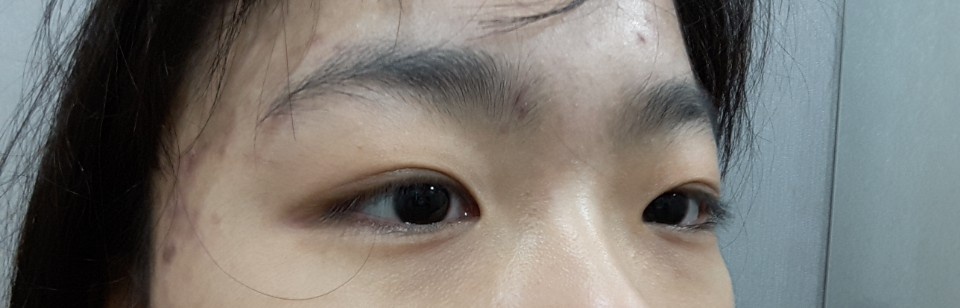 기타 후기