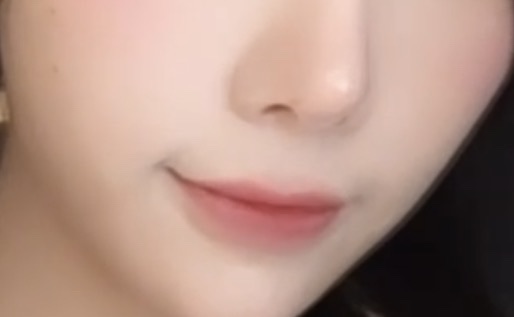 큐피트라인성형 후기