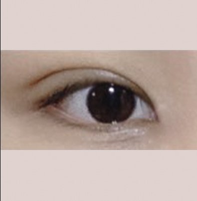 밑트임 후기