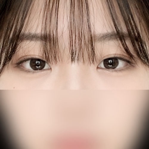 쌍꺼풀(자연유착) 후기