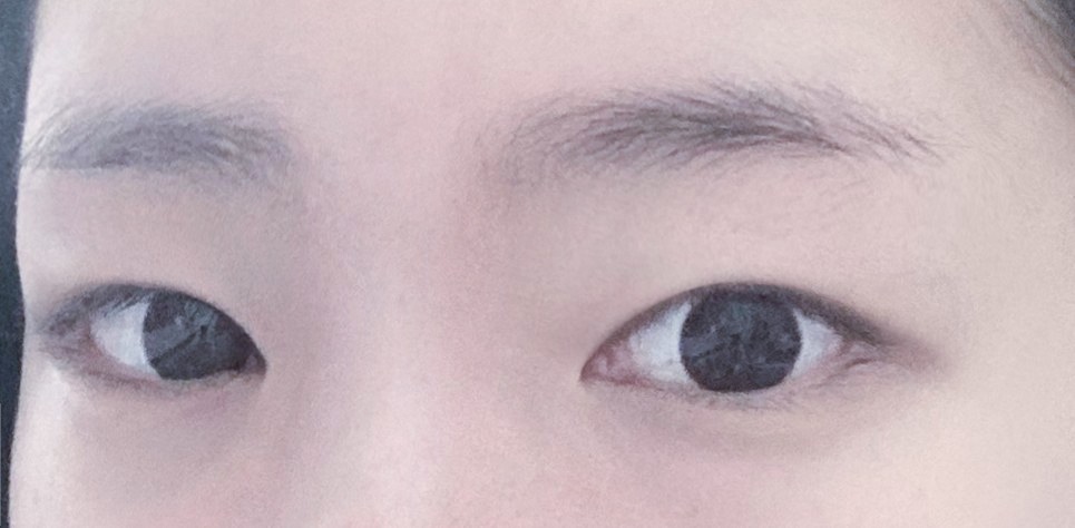 밑트임 후기