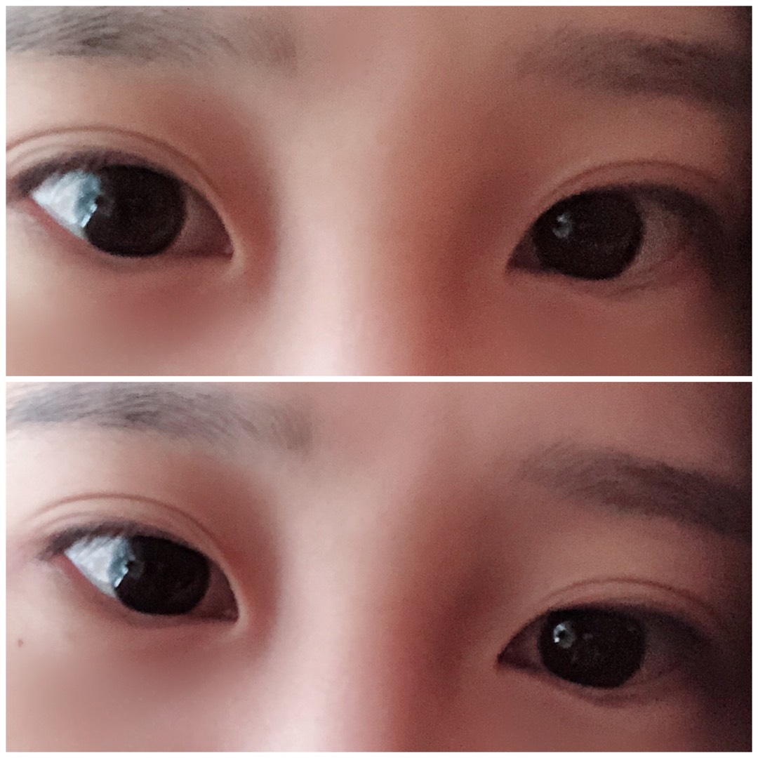 밑트임 후기