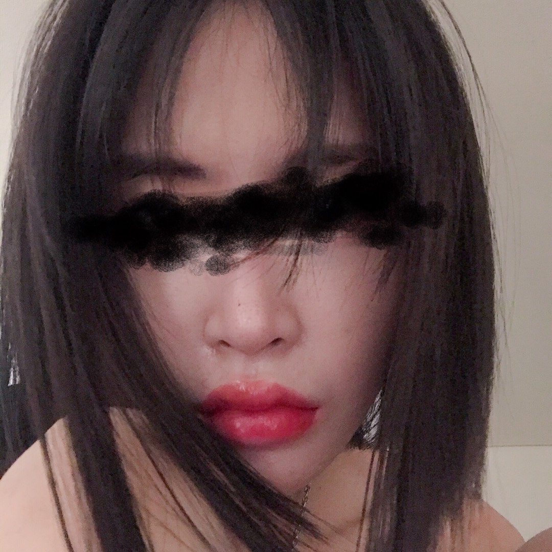 입꼬리성형 후기