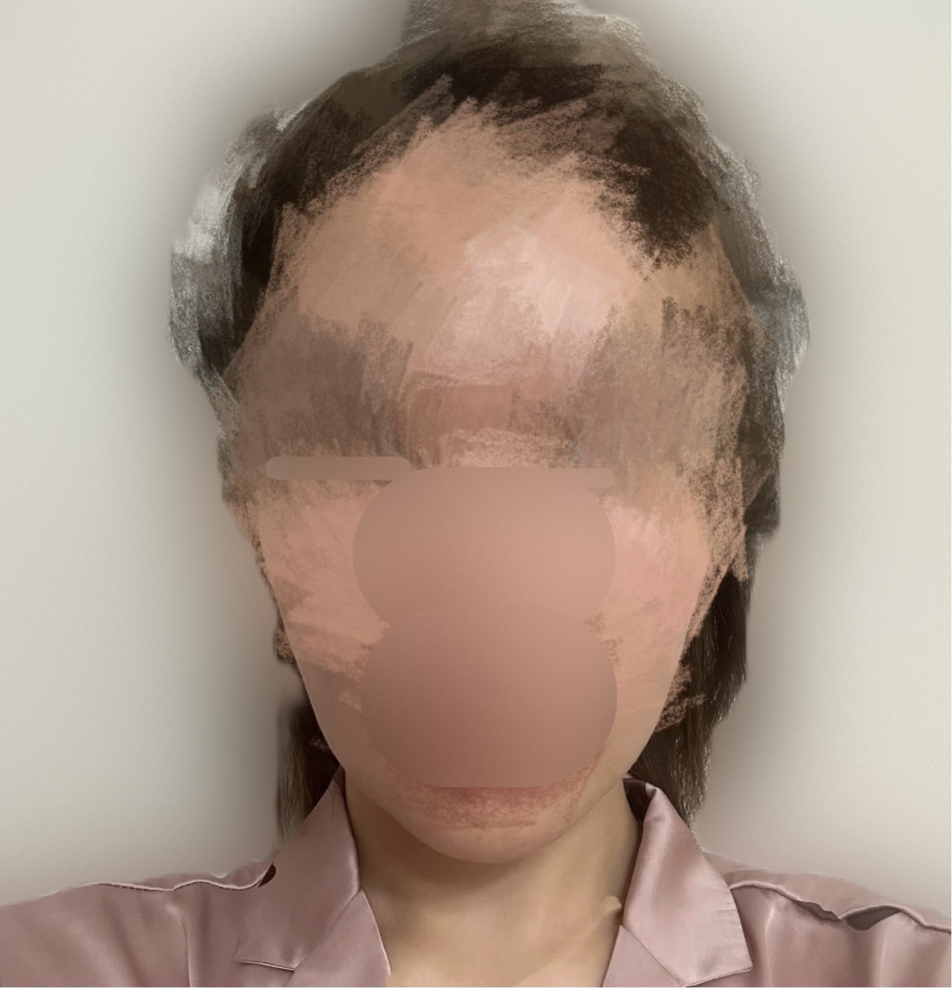 실리프팅 후기