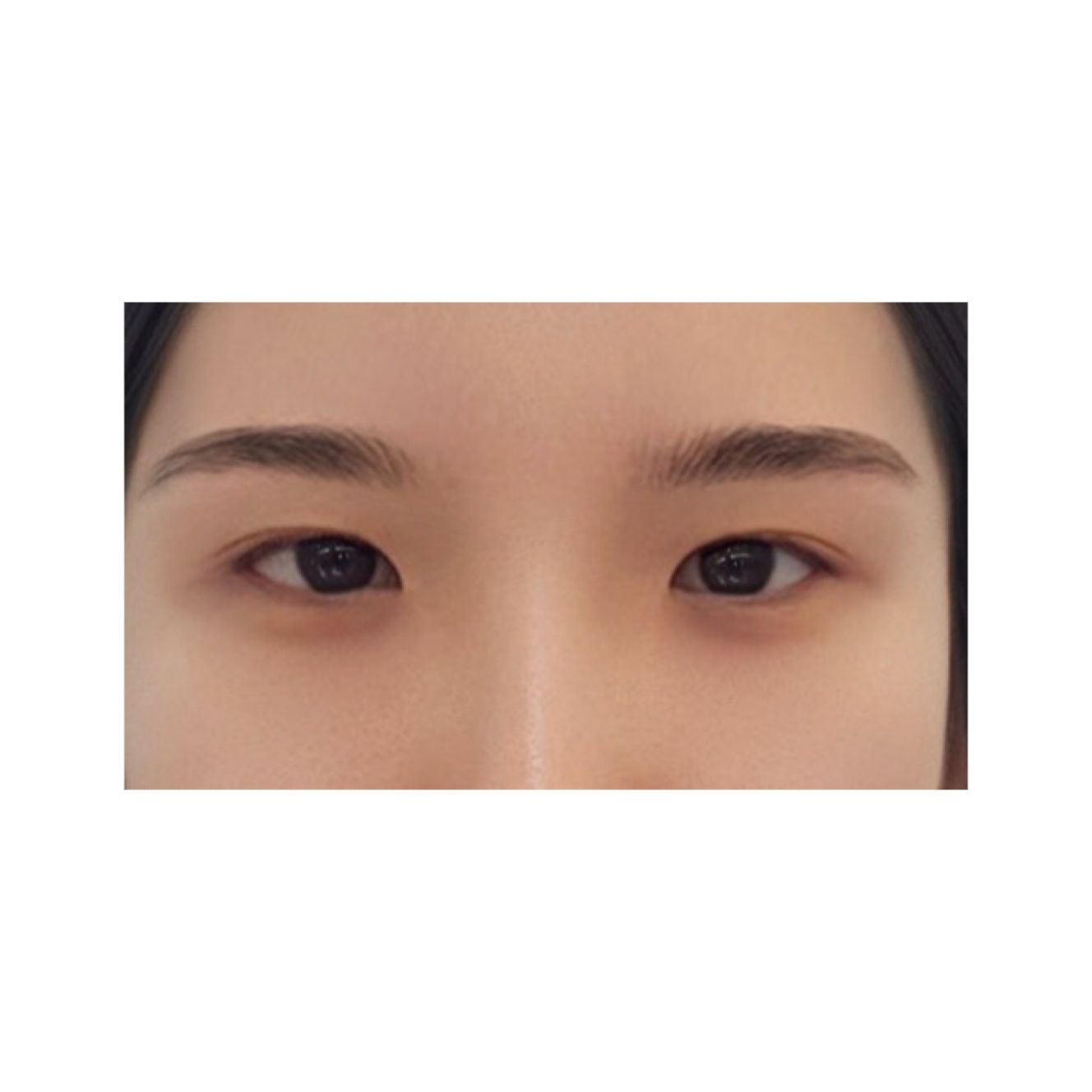 밑트임 후기