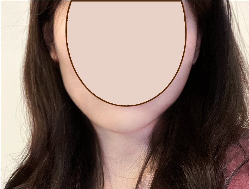 실리프팅 후기