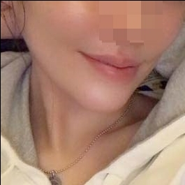 턱끝수술 후기