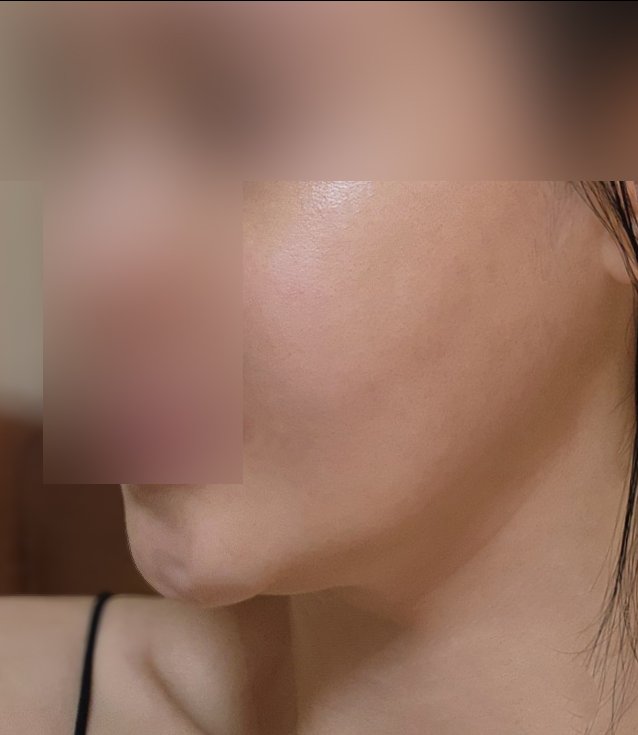 실리프팅 후기