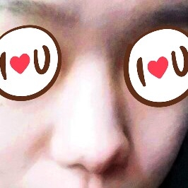 코끝(기증연골) 후기