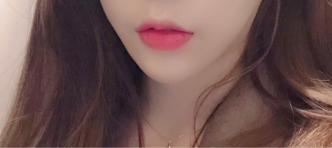 쌍꺼풀(절개) 후기