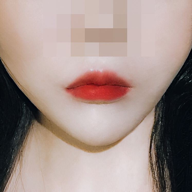 큐피트라인성형 후기