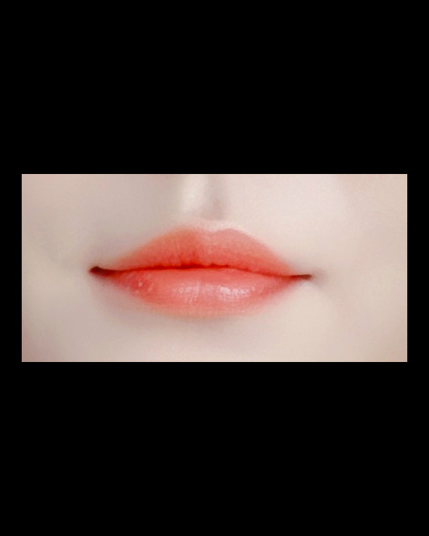 입꼬리성형 후기