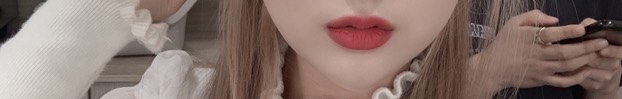 입꼬리성형 후기