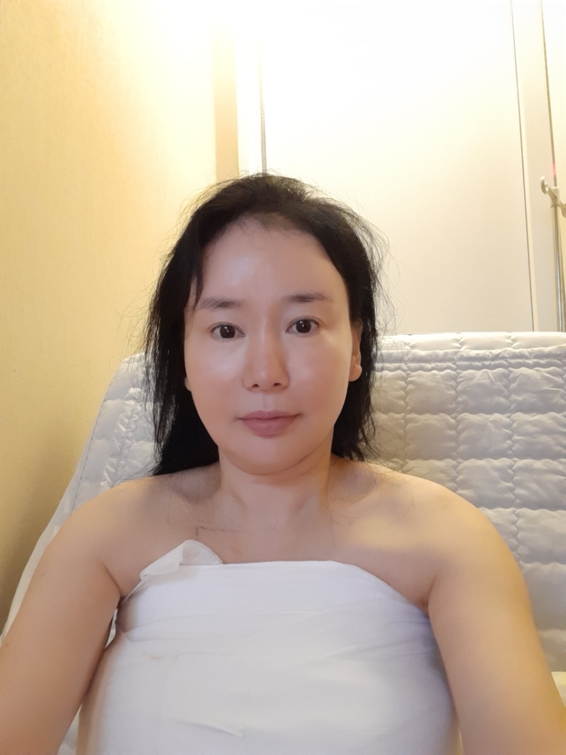 실리프팅 후기