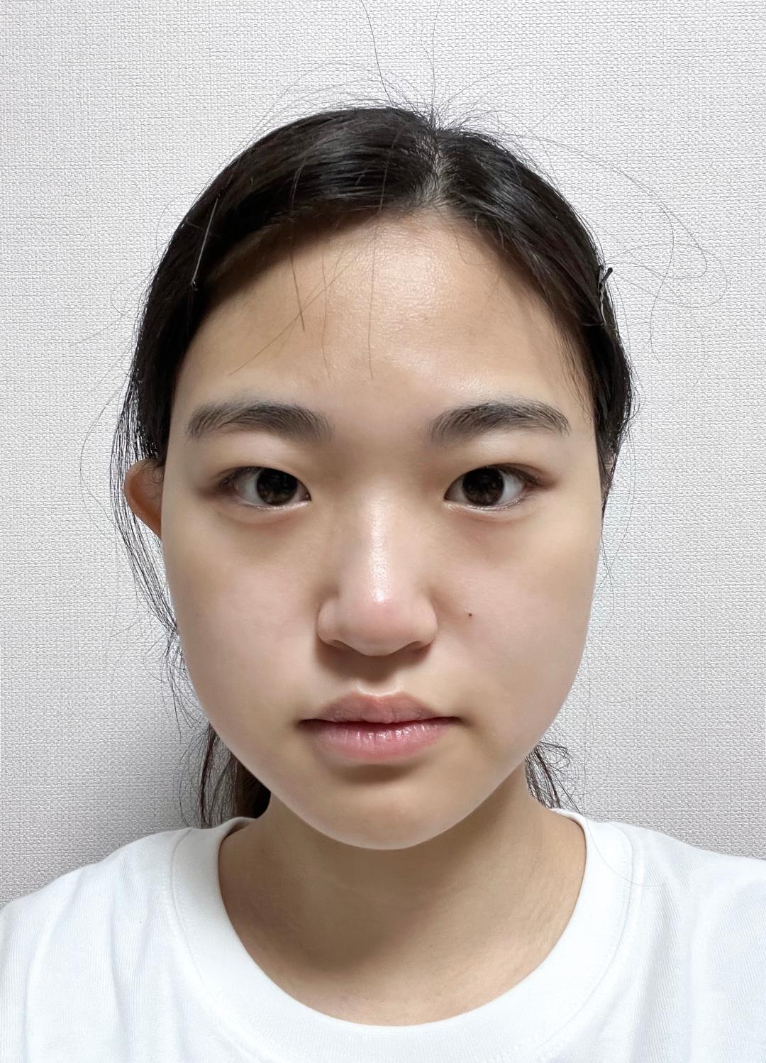 밑트임 후기