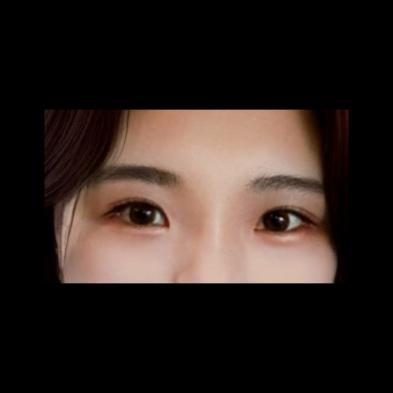 밑트임 후기