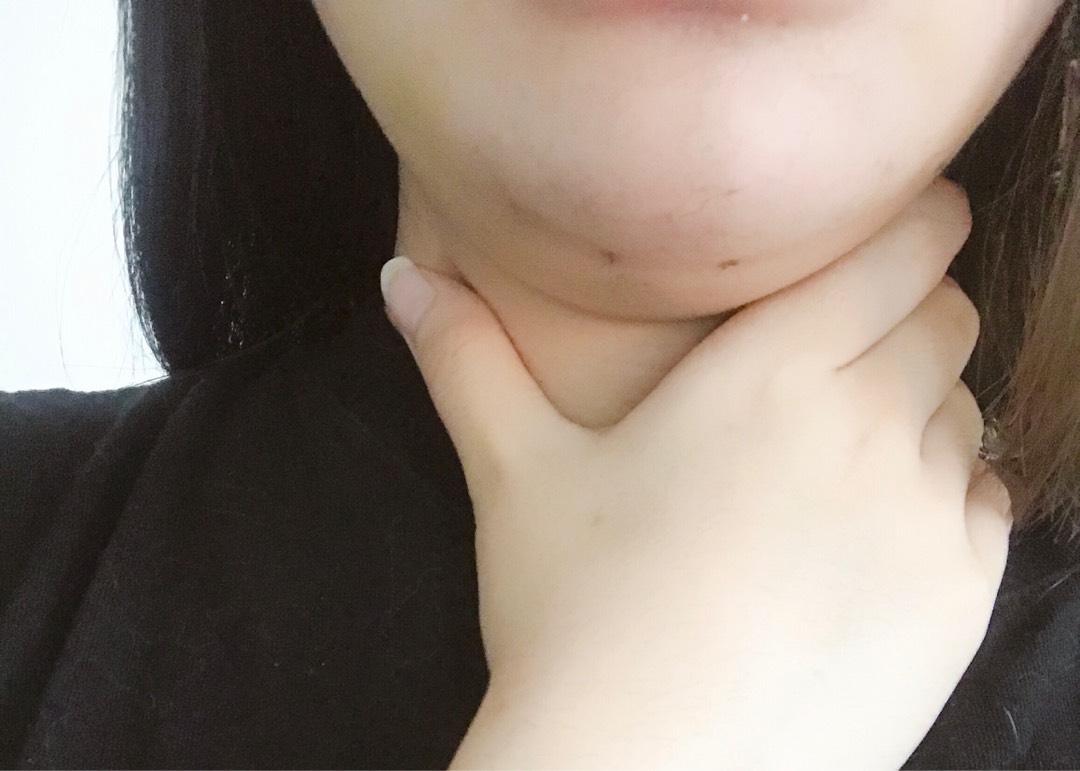 실리프팅 후기