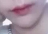 입꼬리성형 후기