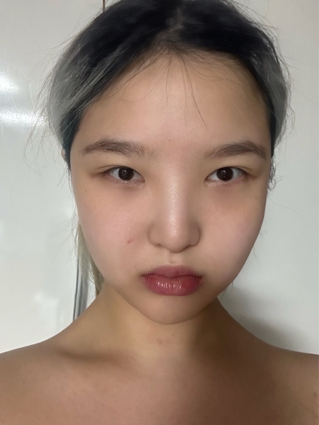 코끝(보형물) 후기