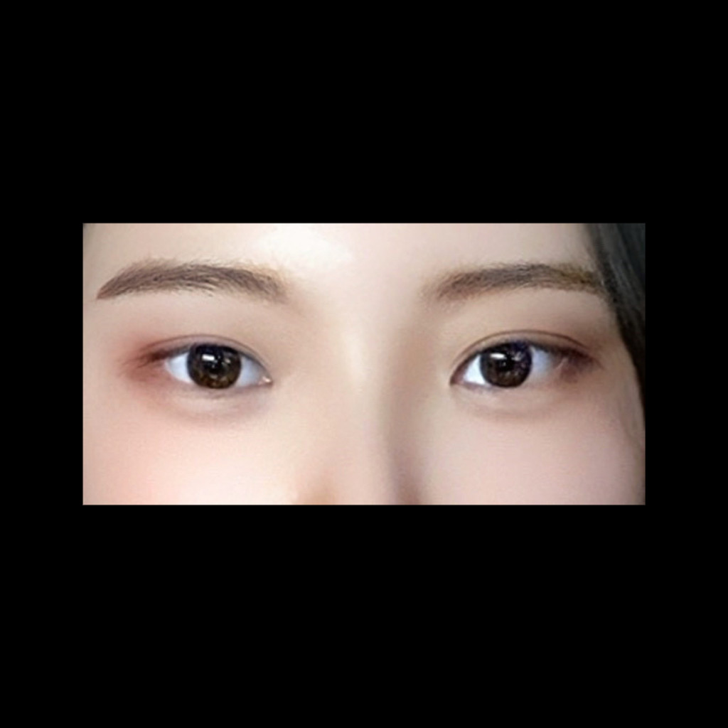 밑트임 후기