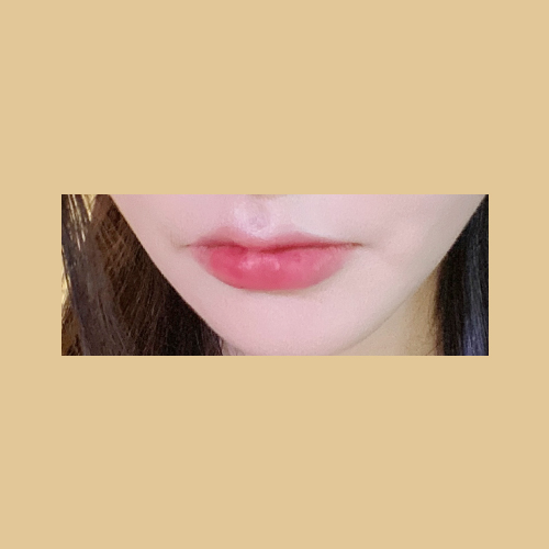 큐피트라인성형 후기